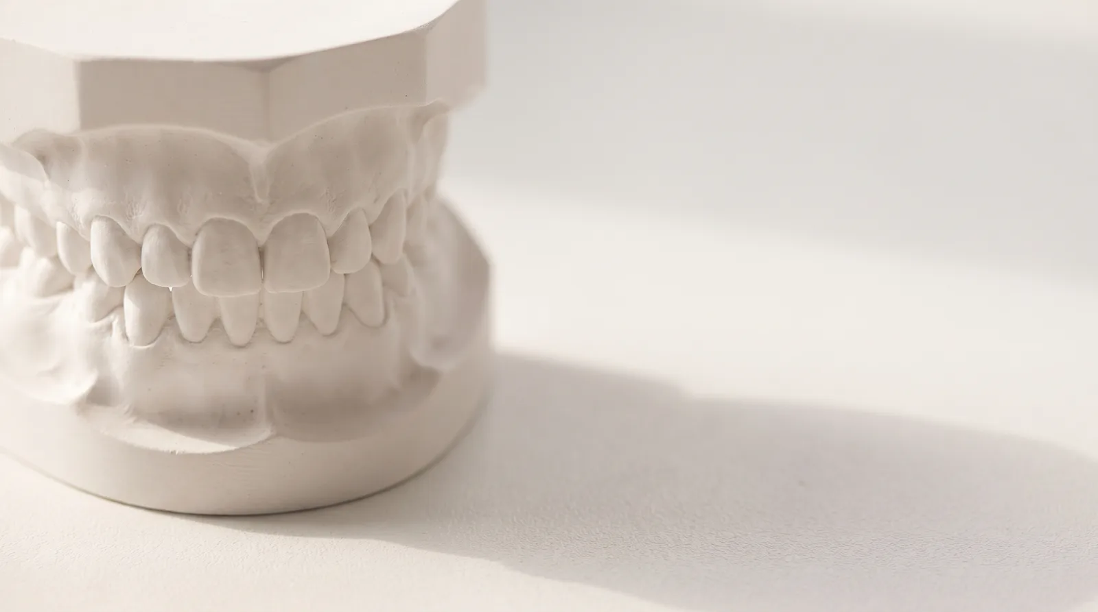 A white upper and lower dental arch study model closed together to show the bite